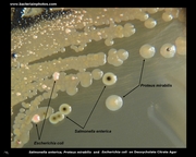 lactose fermentation on deoxycholate agar